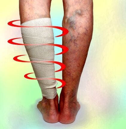 Terapia di compressione