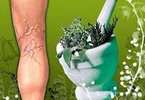 erbe per il trattamento delle vene varicose