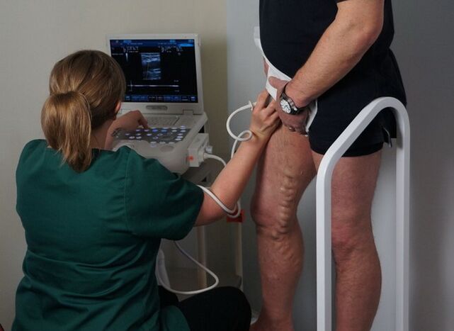 esame delle vene prima della coagulazione laser per vene varicose